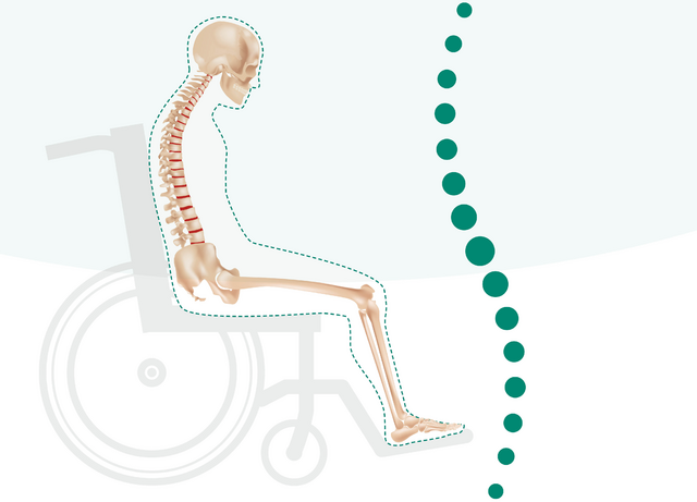 65709f7012e5a643d8577554 Posture management blog thumbnail Guide